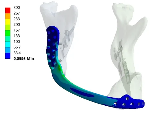 ANSYS Design Example 1