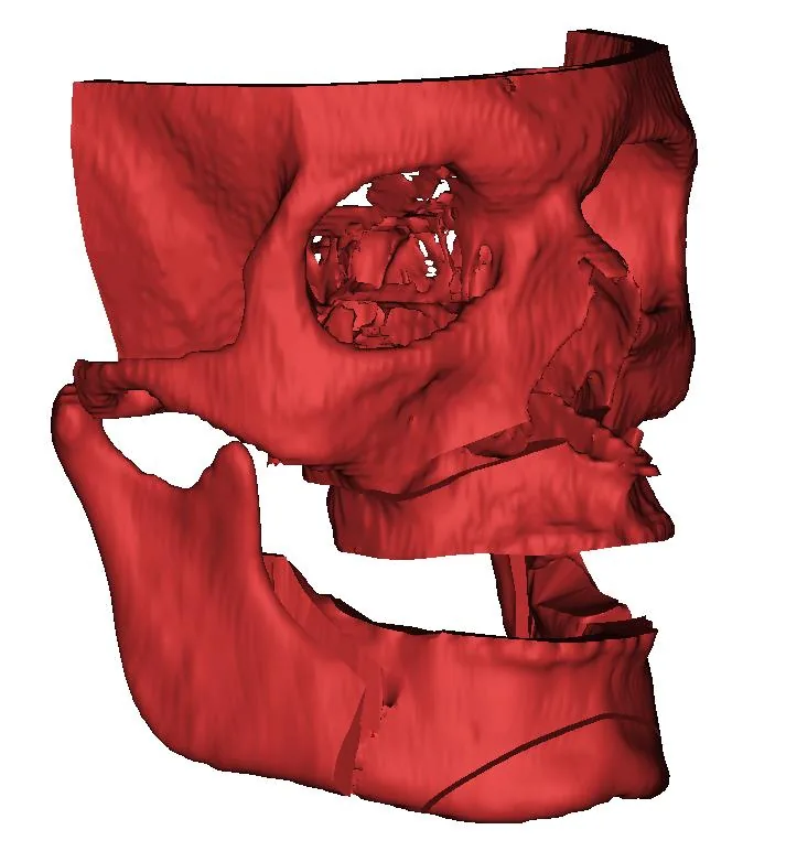 ADD4BIO medikal mühendislik modeli