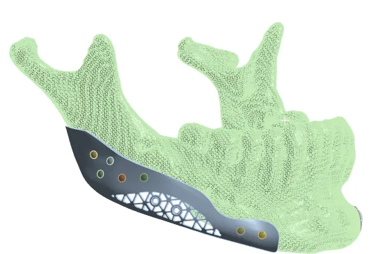 ANSYS Design Example 2